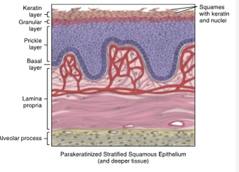 <ul><li><p>associated with masticatory mucosa of the attached gingiva in higher levels</p></li><li><p>it is also associated with specialized mucosa of the lingual papillae on the dorsal surface of tongue</p></li><li><p>basal → prickle→ granular→ keratin</p></li><li><p>granular layer may be indistinct or absent all together</p></li><li><p>cells of the keratin layer contain not only keratin but NUCLEI</p></li><li><p>attached gingiva and mucogingival junction</p></li></ul><p></p>