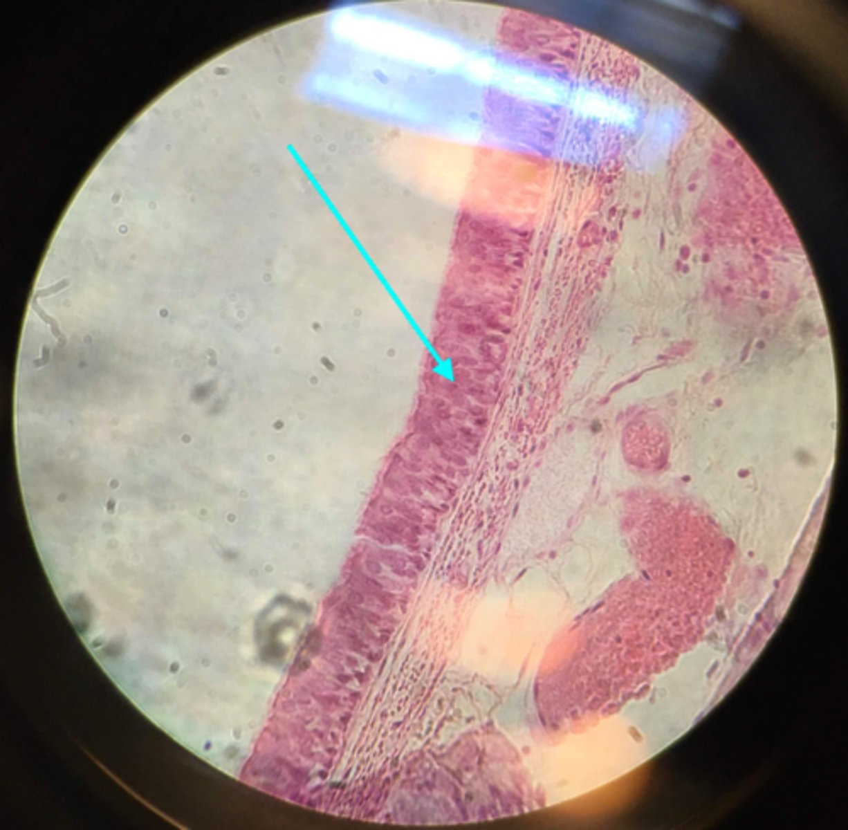 <p>What type of tissue is the blue arrow pointing at on this slide?</p>