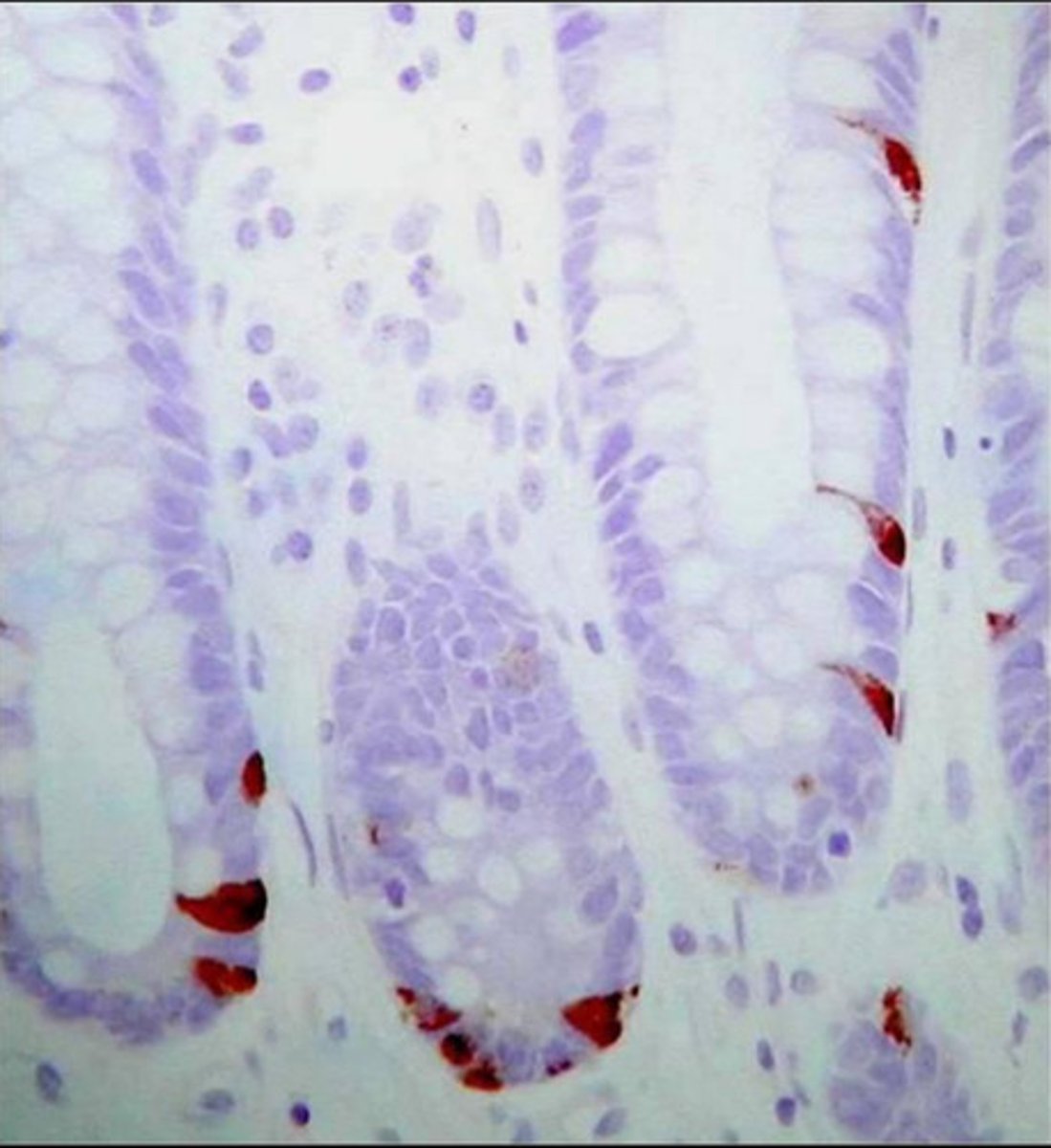 <p>enteroendocrine cells in intestinal crypts</p>