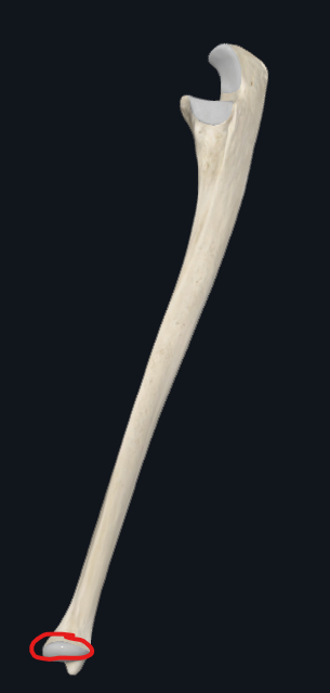 <p>What is this part of the ulna called</p>