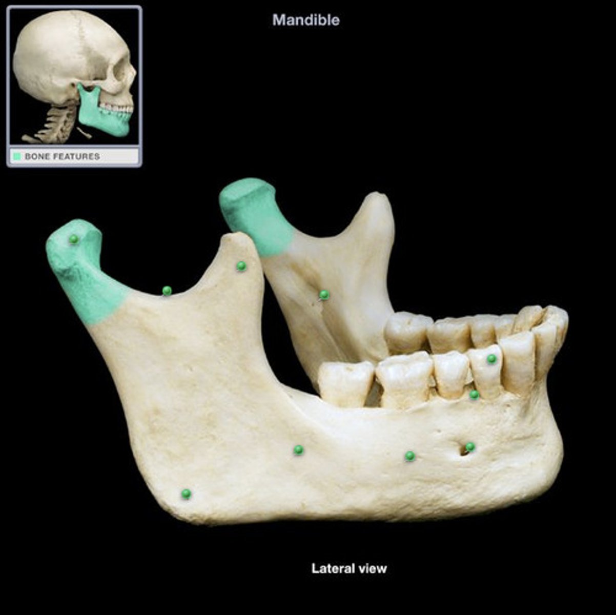 <p>mandible</p>