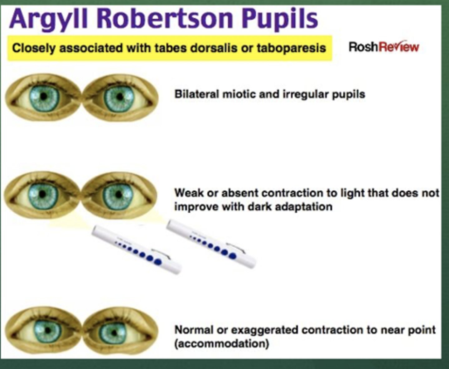 <p>Define Argyll-Robertson Pupils</p>