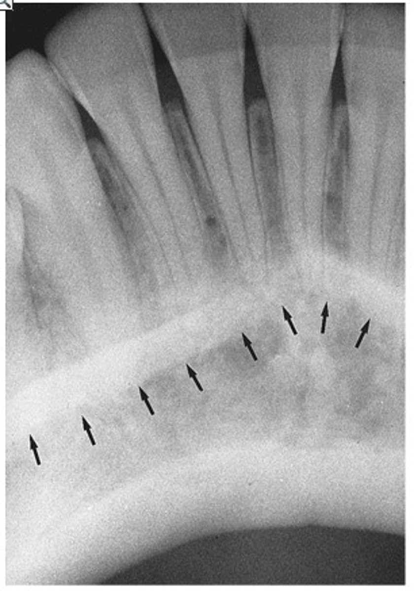 <p>What is the radiopaque structure seen here?</p>