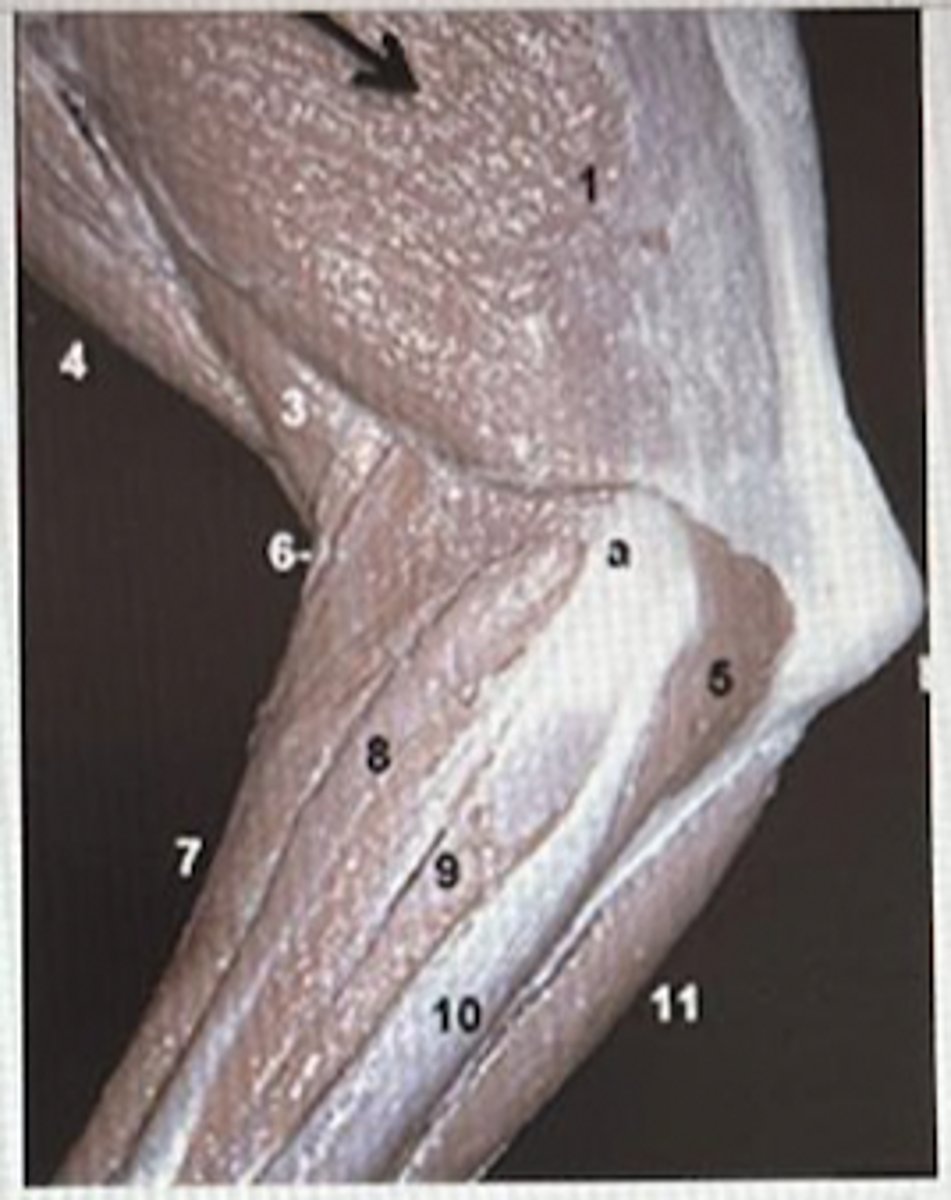 <p>B</p>