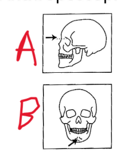 <p>Vad är a)?</p>