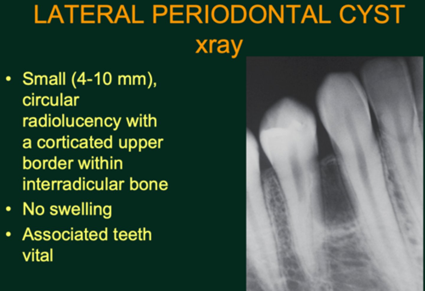 <p>Odontogenic, non-inflammatory</p>