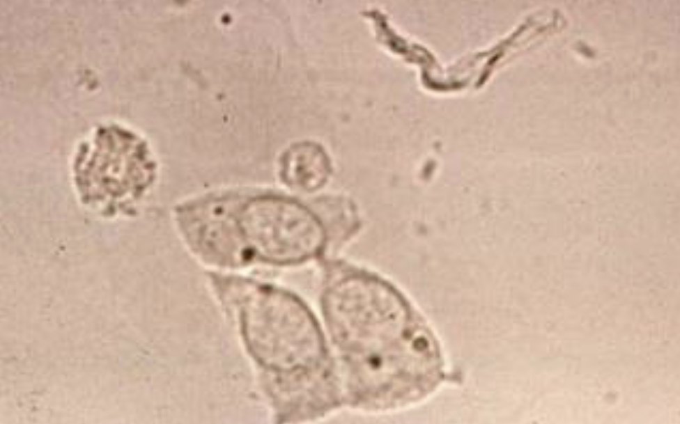 <p>What is located beside the WBC?</p><p>Where are these produced?</p><p>What does it normally indicate when you see these?</p>