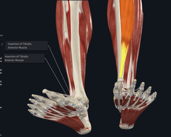 <p>Insertion: tibialis antertior</p>