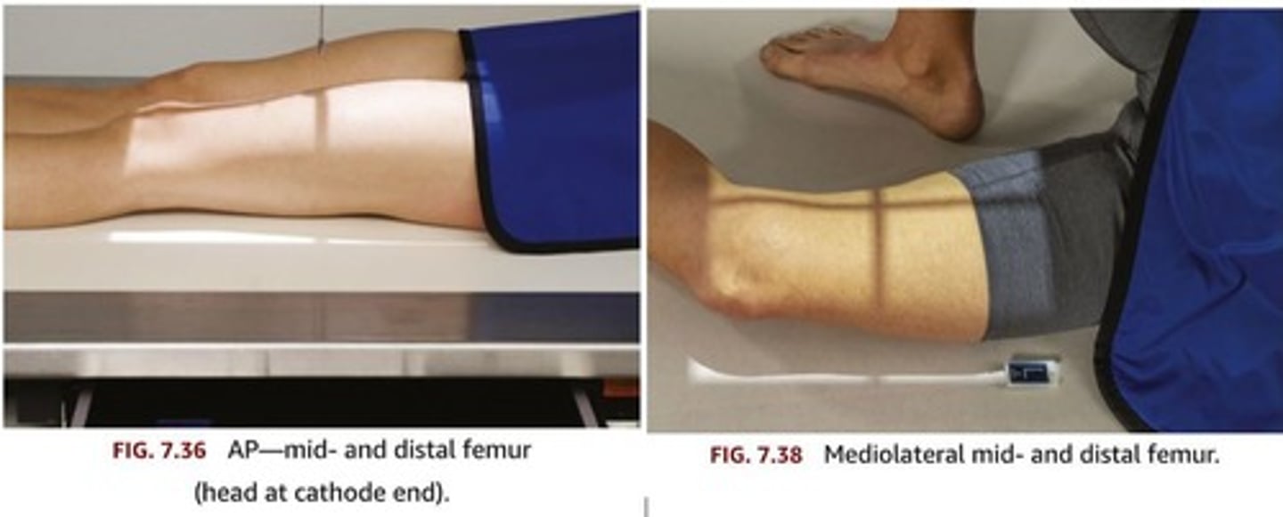 <p>- Antero-posterior (AP)</p><p>- Lateral</p>