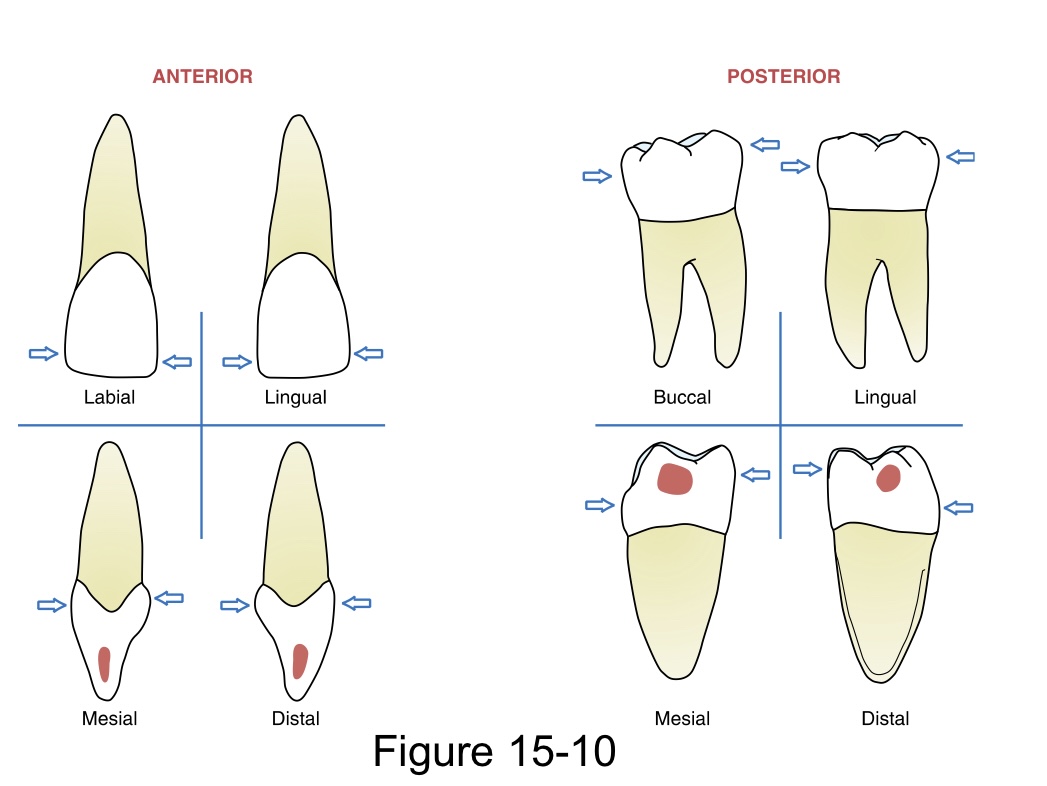 <p>is the greatest elevation of the tooth either incisocervically or occlusocervically&nbsp;</p>