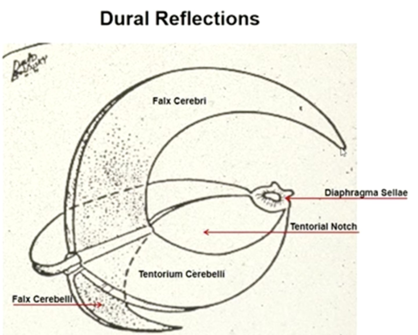 <p>the area where dura mater folds + dives into spaces between parts of the brain. Two areas: falx cerebri and tentorium cerebelli.</p>