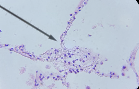 <p>what tissue is this </p>