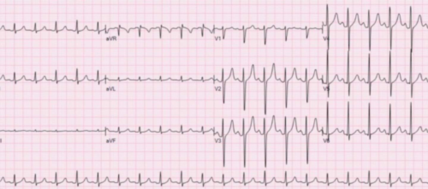 <p>What are the findings</p>