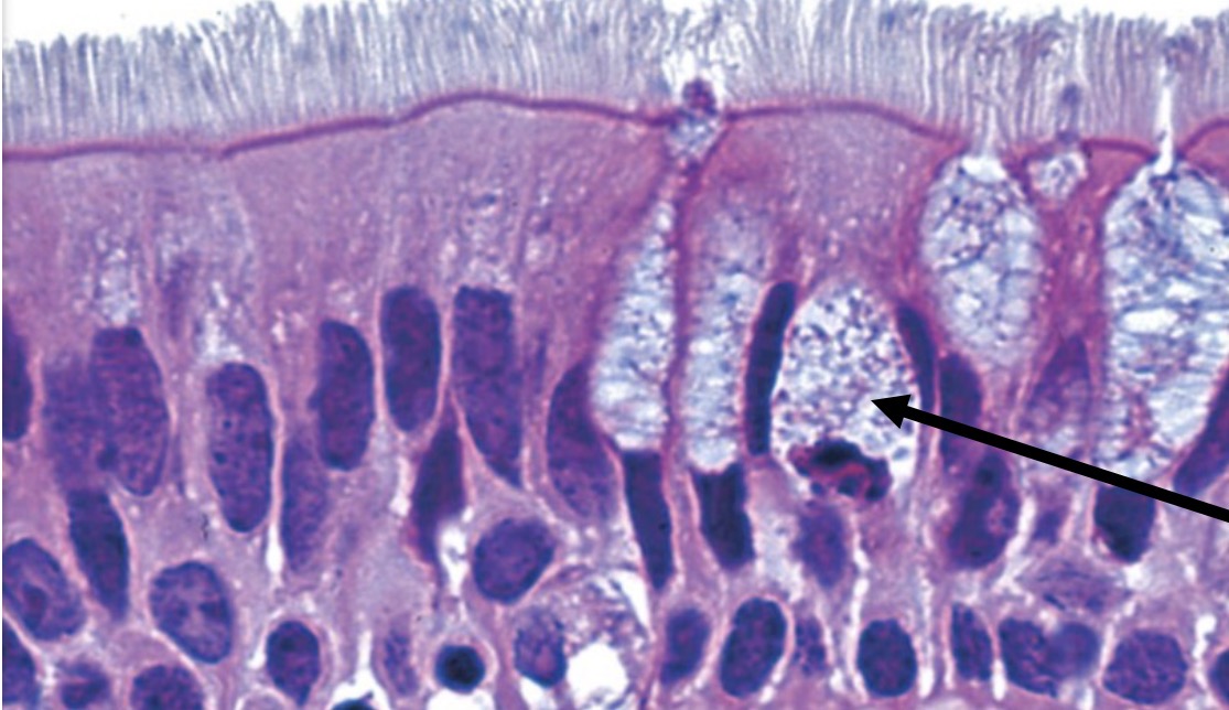 <p>Identify the type of tissue and the<br>structure at the arrow</p>