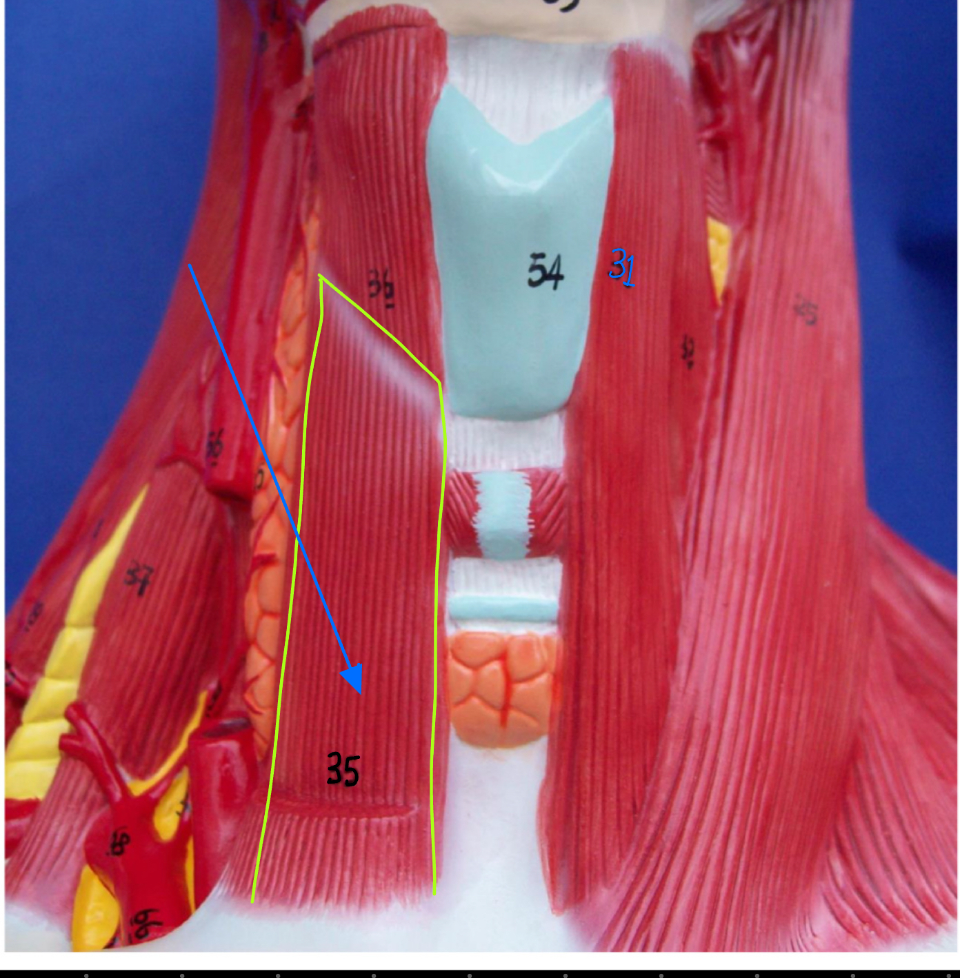 <p>what type of muscle is this ( altay model)</p>