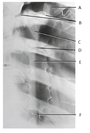 <p>A</p>