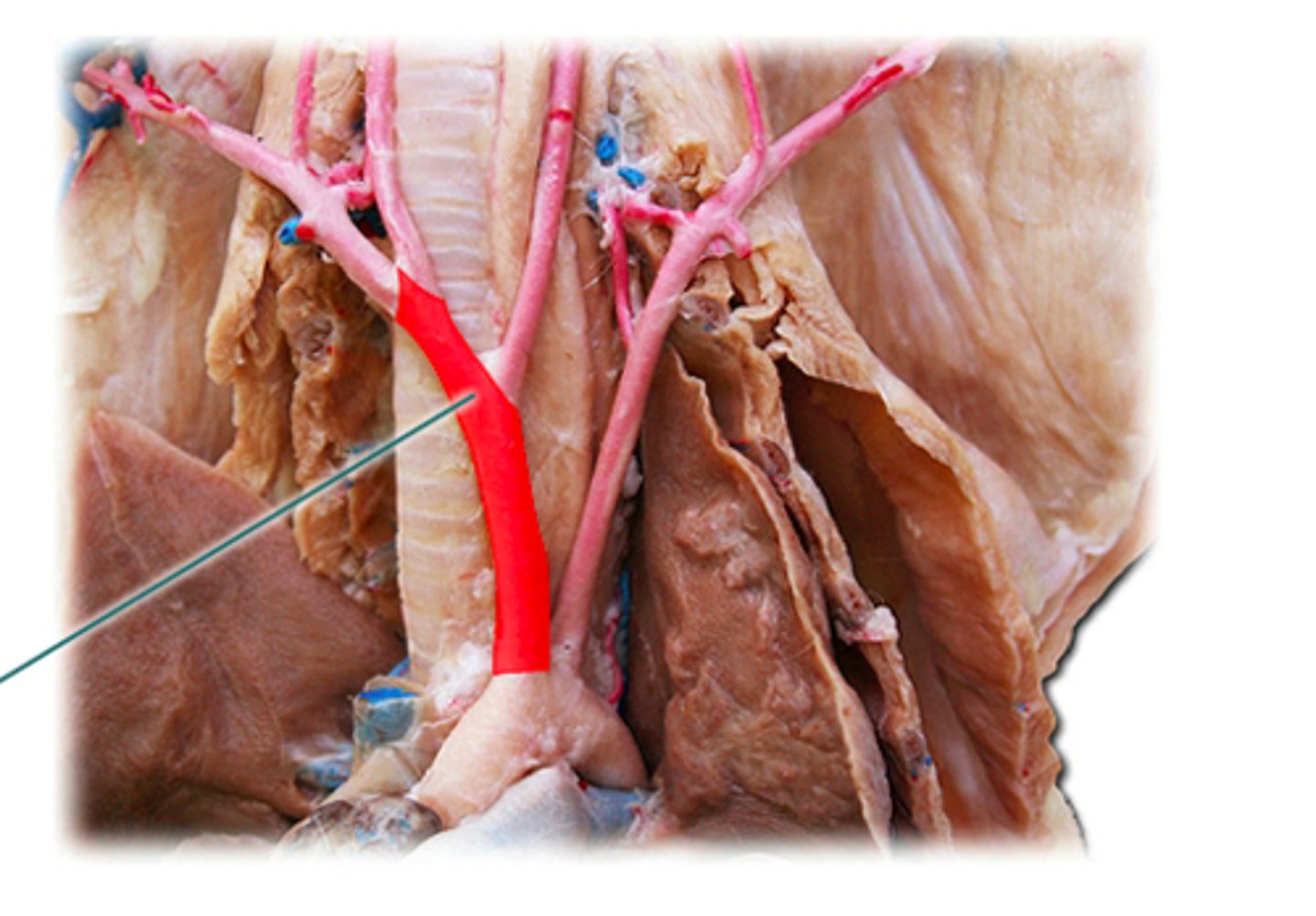 <p>right branch off the aortic arch</p>