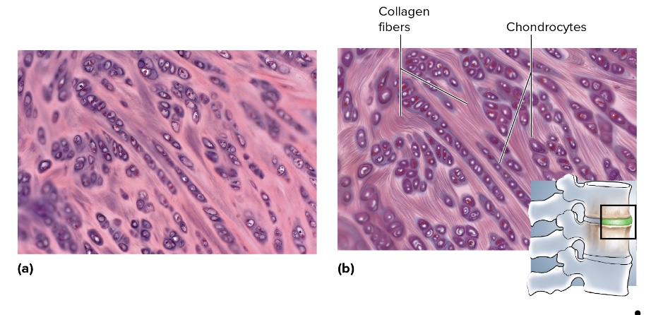<p>location of fibrocartilage</p>