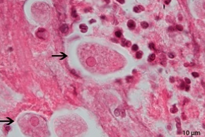 <p>Professor: Dr. Glena Fe A. Yapchulay-Alcabasa</p>