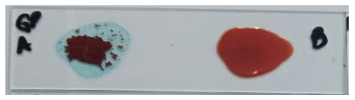 <ul><li><p><strong>Blood Group: </strong>A</p></li><li><p><strong>Antibody/Antibodies Present: </strong>Anti-B</p></li><li><p><strong>Antigen(s) Present:</strong> A</p></li></ul><p></p>