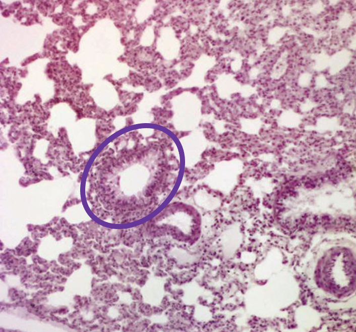 Identifying features:

•ciliated SIMPLE columnar epithelium

•Goblet cells

•NO CARTILAGE

•ALL SMOOTH MUSCLE