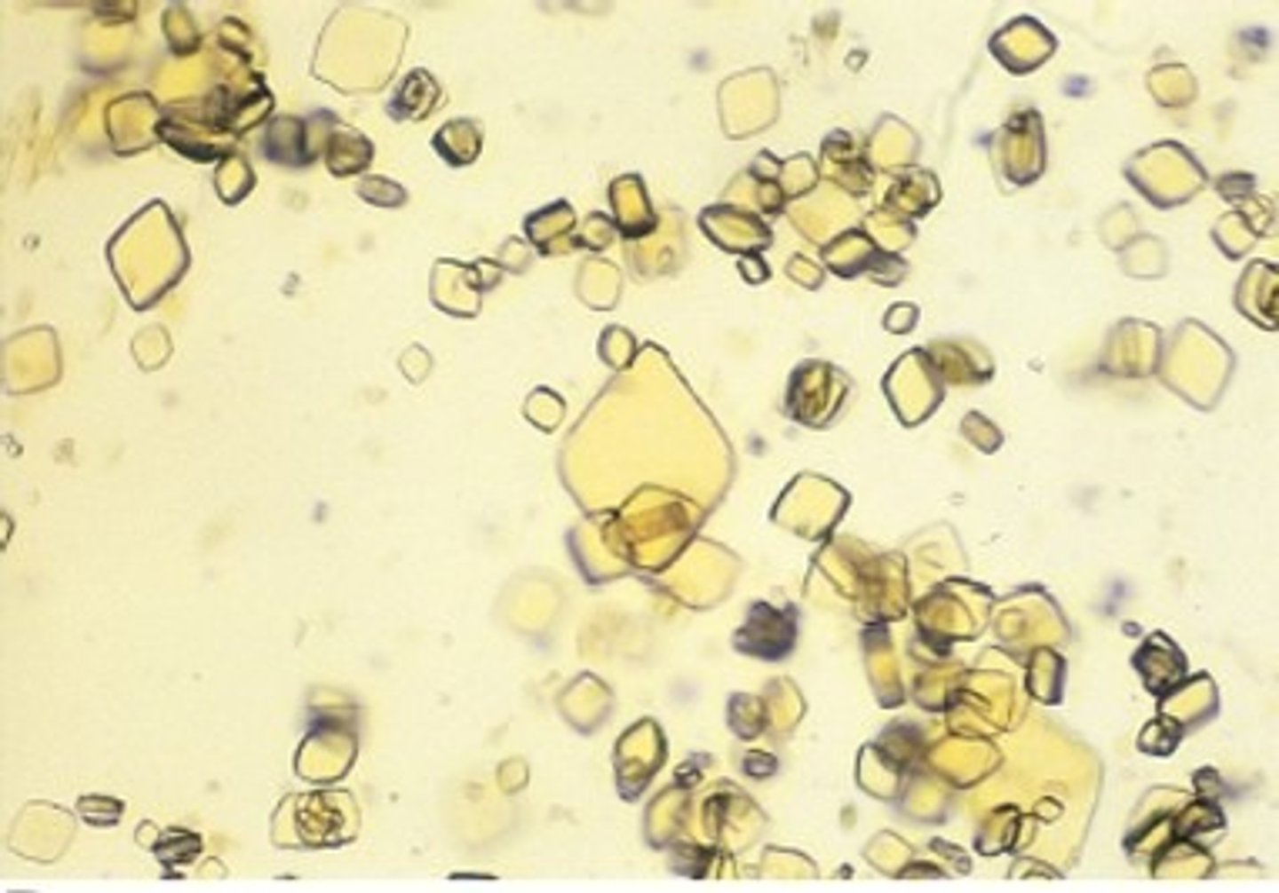 <p>variety of shapes, yellow or brown; not common except in dalmations</p>