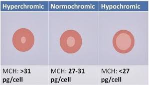 <p>RBC are normal color</p>