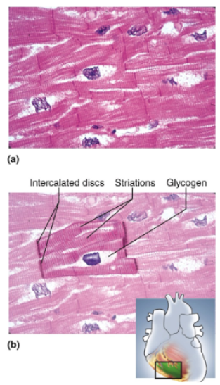 <p>Short Cells (Cardiomyocytes) with notched or slightly branched ends; less parallel appearance in tissue sections; striations; intercalated discs; one nucleus per cell, centrally located and often surrounded by a light zone</p>