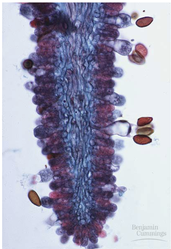 <p>What is this and how many spores does it have?</p>