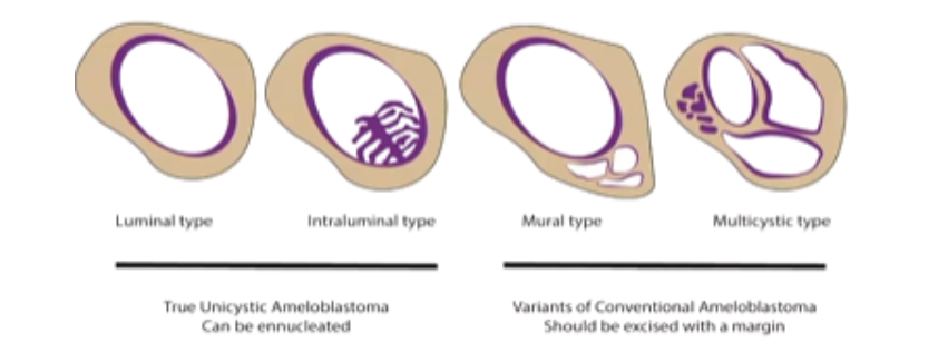 <p>1) Luminal Type</p><p>2) Intraluminal Type</p>