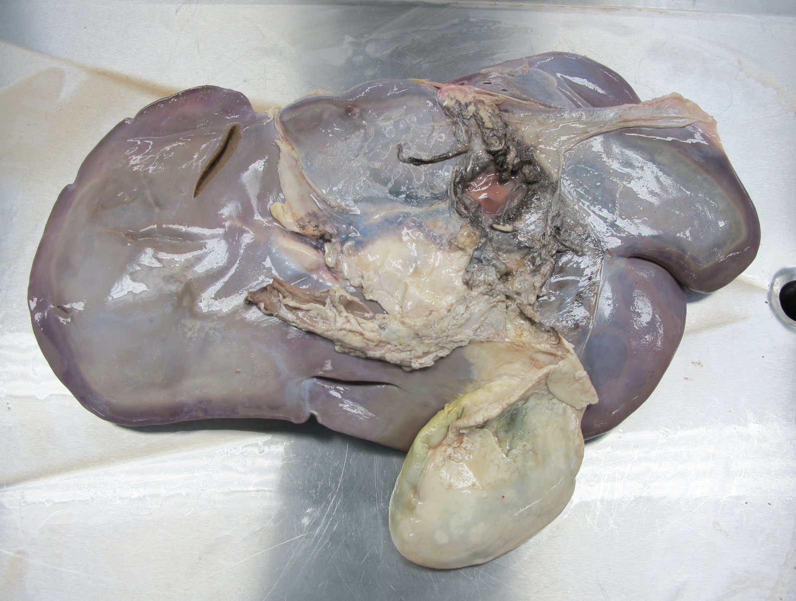 <p>Which species’ liver is shown in this picture? What are its characteristics?</p>