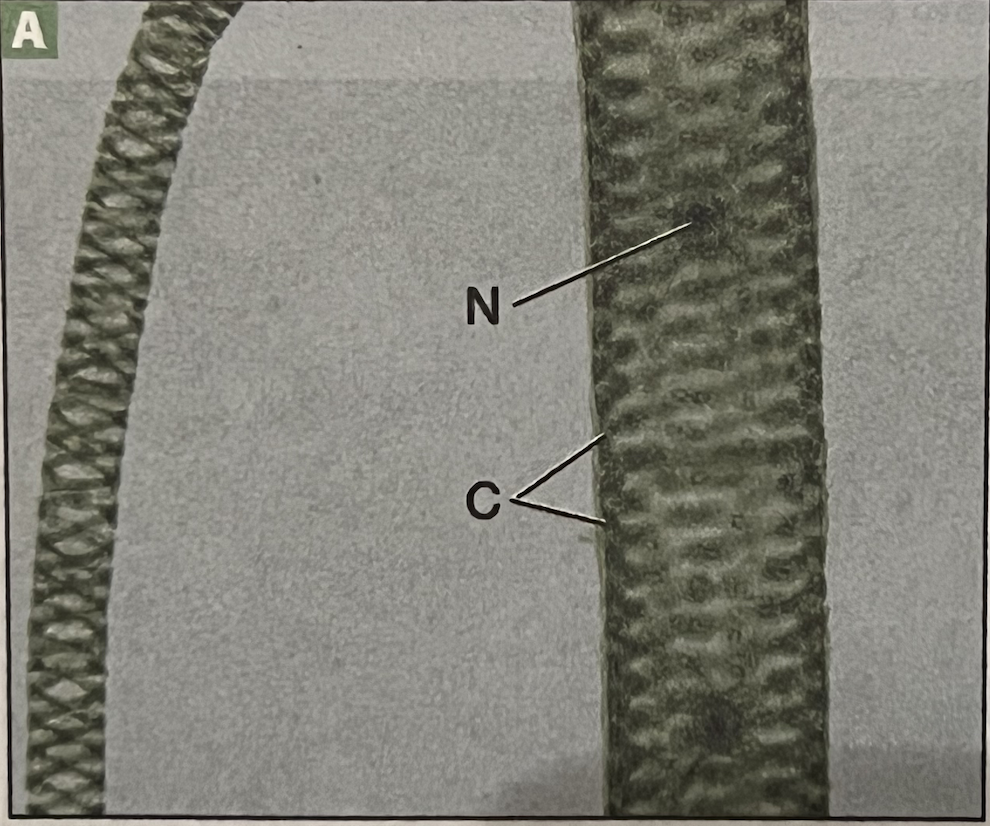 Spirogyra (vegetative) 