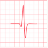 <ul><li><p>supraventricular in origin </p></li></ul><p></p>