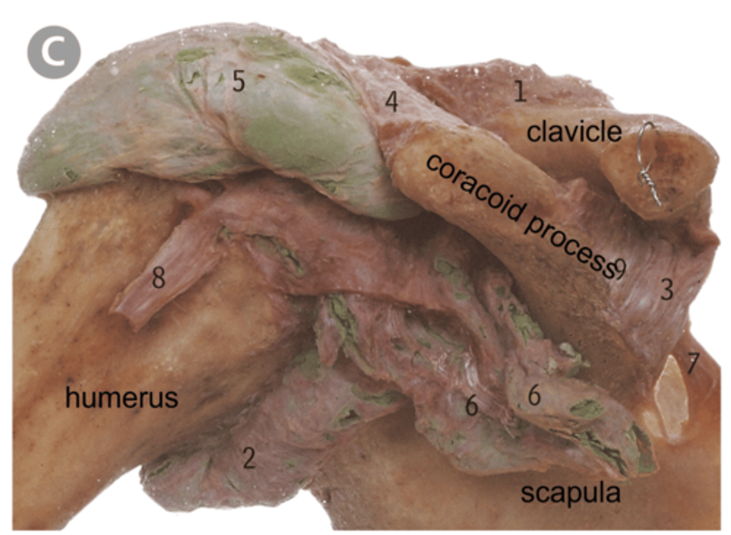 <p>Bursae of the GHJ</p>