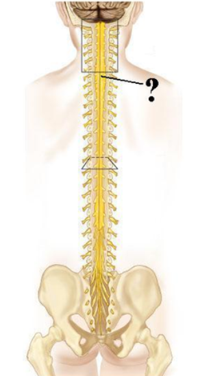 <p><span><span>Identify the indicated structure.</span></span></p>