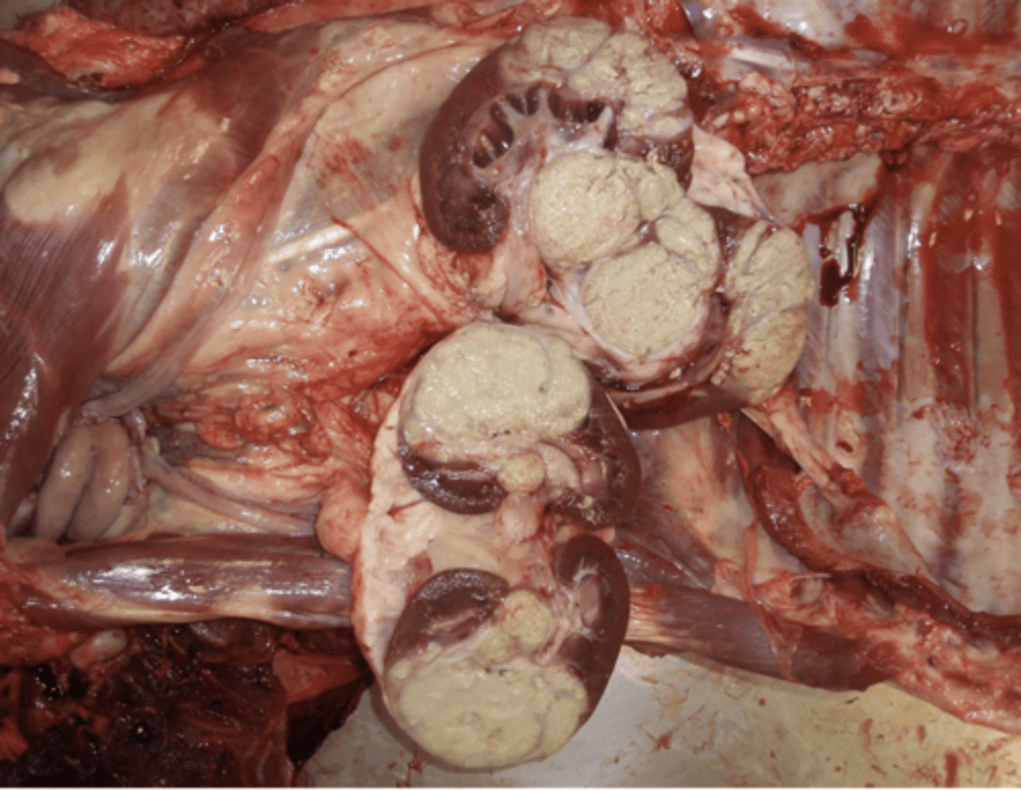 <p>caseous necrosis</p>