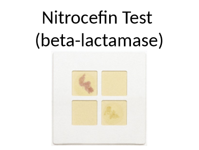 <p>what does the yellow and pink tell us</p>