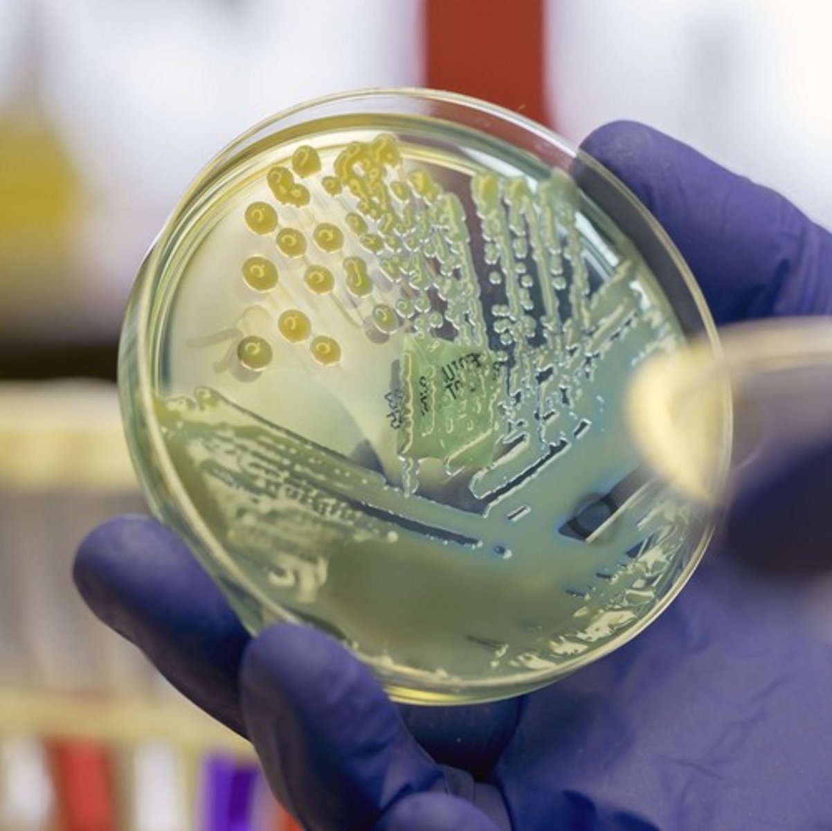 <p>To identify the specific bacteria causing an infection and determine the most effective antibiotic.</p>