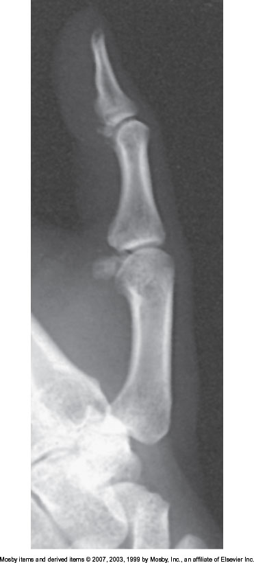 <p>What position is demonstrated?</p>