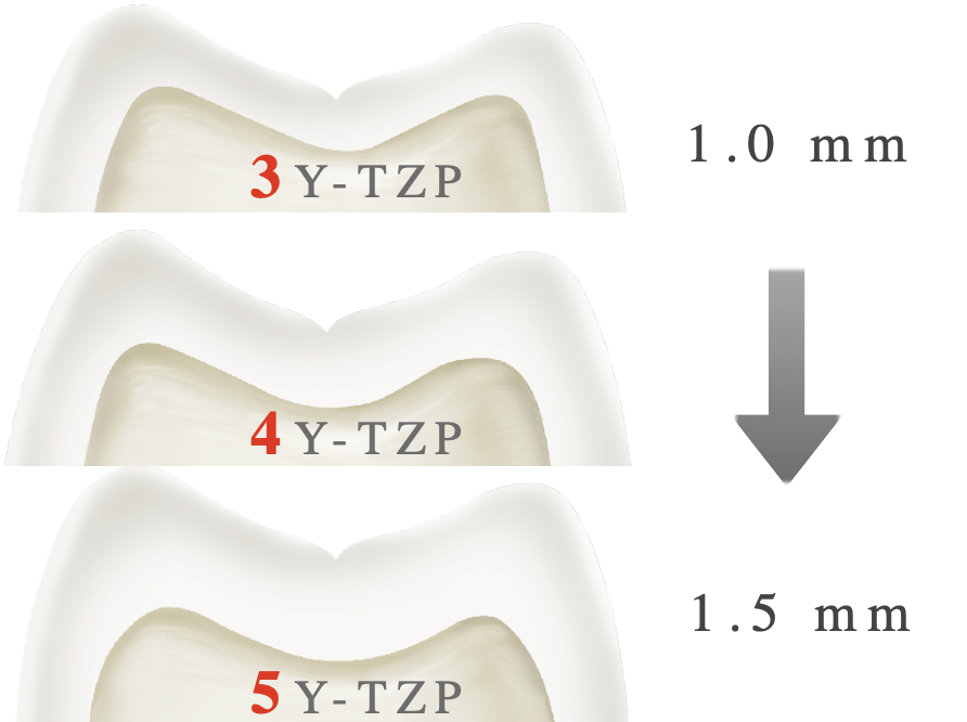 <p>3Y < 4Y < 5Y </p><p>(more translucent material → more occlusal reduction)</p>