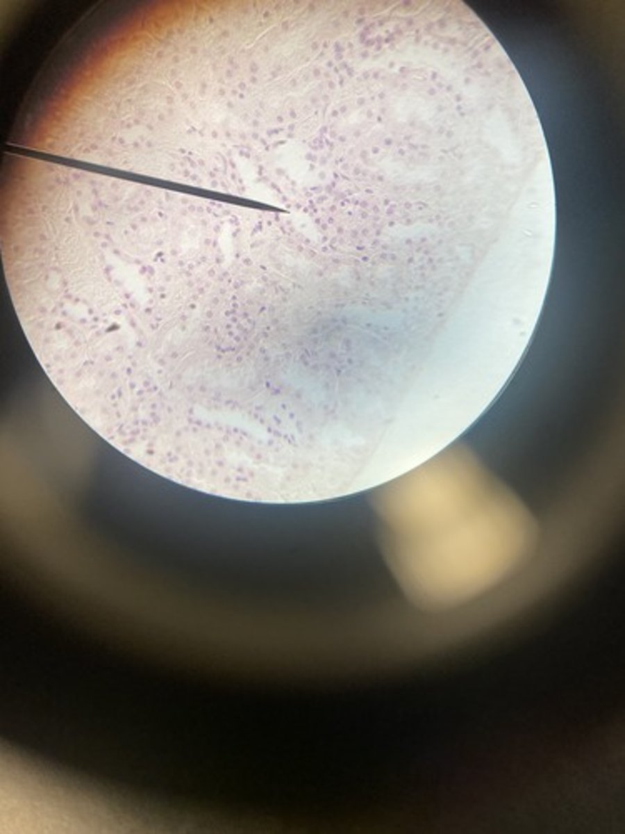 <p>What type of epithelium</p>
