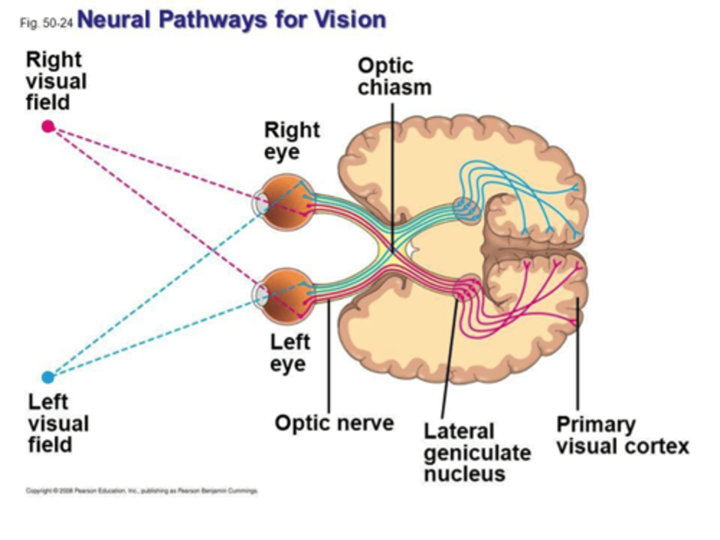 <p>retina -&gt; optic nerve -&gt; optic chiasm -&gt; optic tracts -&gt; lateral geniculate nucleus (LGN) of thalamus -&gt; visual radiations -&gt; visual cortex</p>