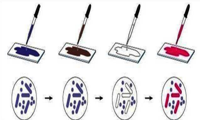 <p>Gram Staining Technique</p>