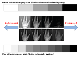 <p>Advantages of digital radiography systems (CR, DDR and IDR) </p>