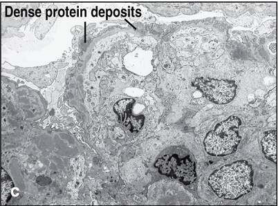 <p>What condition is this</p>