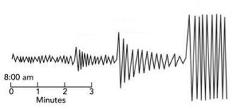 <p><span><span>In this diagram, the approximate lag time between the arrival of the P and S wave is _________.</span></span></p><p></p><ul><li><p>about 1.5 minutes</p></li><li><p>about 3 minutes</p></li><li><p>about 4 minutes</p></li><li><p>about 6 minutes</p></li></ul><p></p>