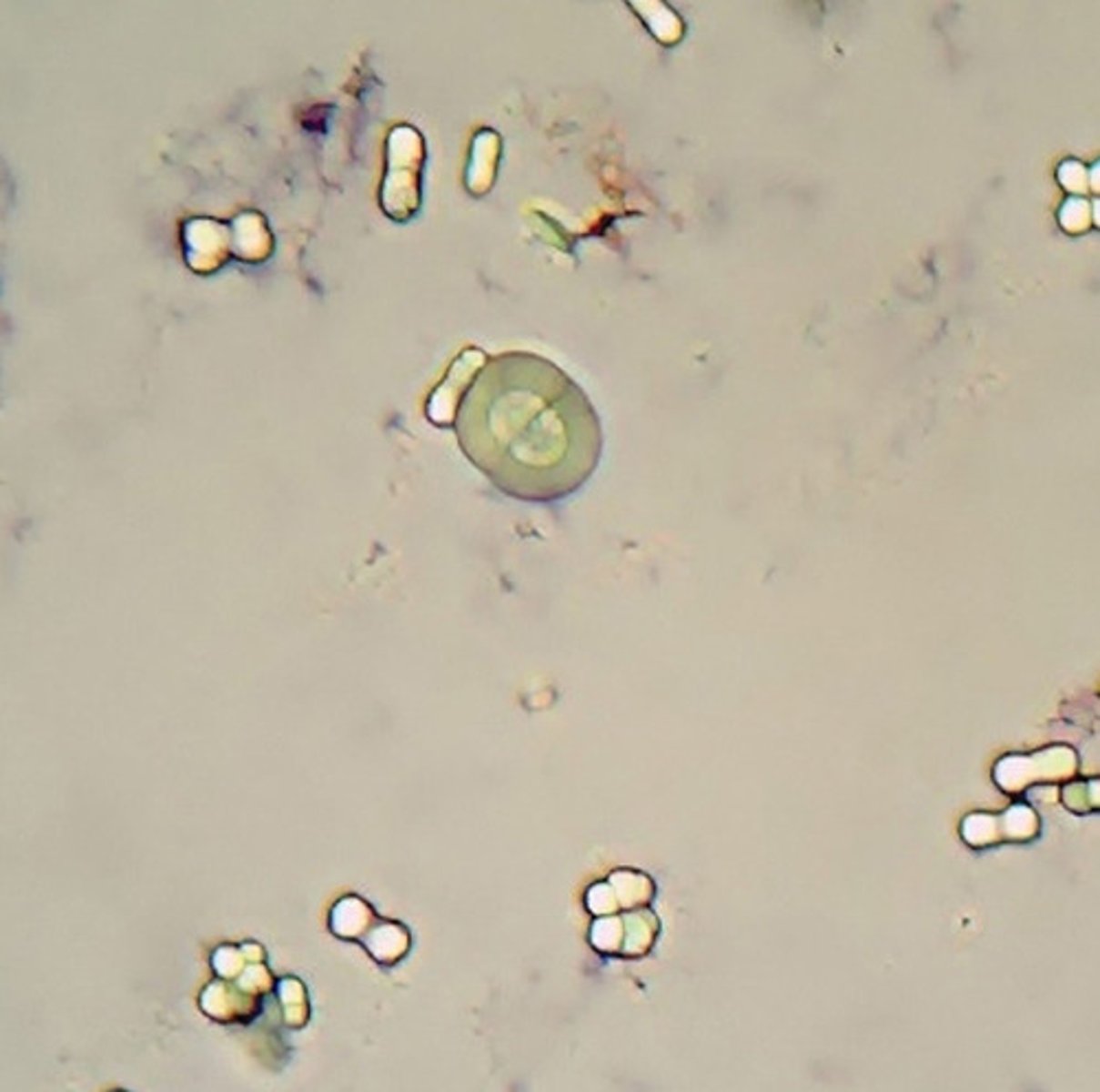 <p>found in alkaline urine; Colorless dumbbells or aggregates</p>