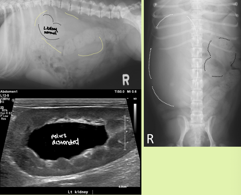 <p>enlarged smooth kidneys with distended pelvis ± distended ureters</p>