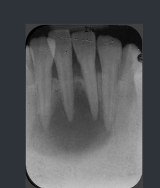 <p>What type of radiograph is this?</p>