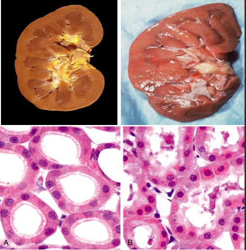 <p>what is this ? </p><p>other types of reversible injury ?</p>